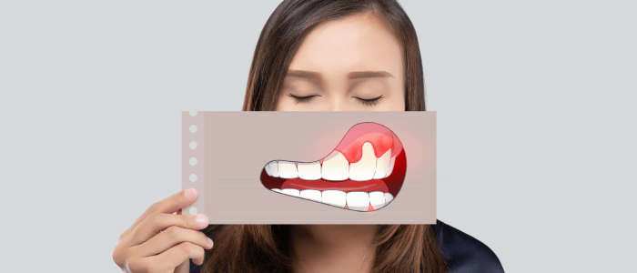  oral cancer surgeon bangalore